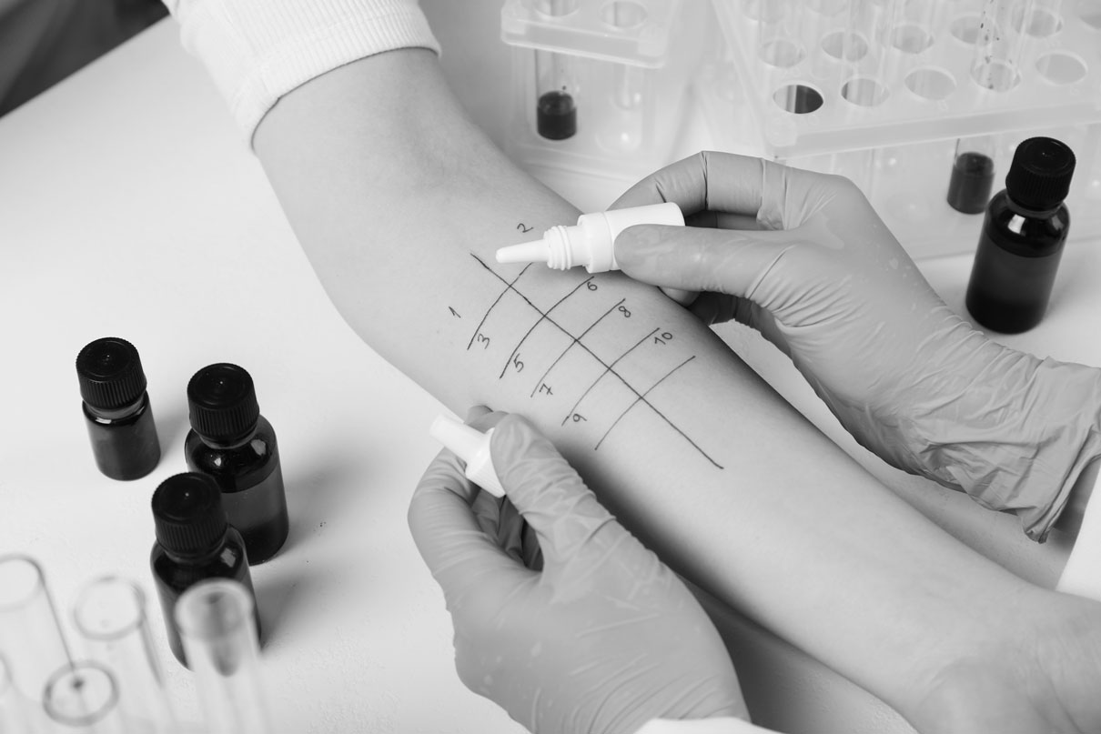 allergologia