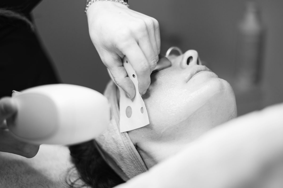 laser terapia